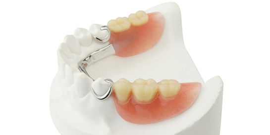 Abnehmbarer und festsitzender Zahnersatz